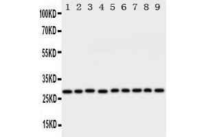Western Blotting (WB) image for anti-Peroxiredoxin 3 (PRDX3) (AA 239-256), (C-Term) antibody (ABIN3044200) (Peroxiredoxin 3 antibody  (C-Term))