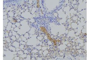 Immunohistochemistry (IHC) image for anti-Heat Shock Protein 90kDa beta (Grp94), Member 1 (HSP90B1) (C-Term) antibody (ABIN6262407)