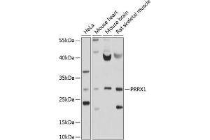 Western blot analysis of extracts of various cell lines, using PRRX1 antibody (ABIN6128507, ABIN6146277, ABIN6146278 and ABIN6214409) at 1:1000 dilution. (PRRX1 antibody  (AA 1-90))