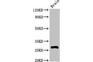 Western Blot Positive WB detected in: Mouse brain tissue All lanes: DNAJC4 antibody at 3. (DNAJC4 antibody  (AA 1-155))