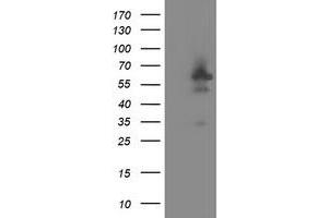 HEK293T cells were transfected with the pCMV6-ENTRY control (Left lane) or pCMV6-ENTRY DOK7 (Right lane) cDNA for 48 hrs and lysed. (DOK7 antibody)