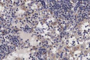 ABIN6266699 at 1/100 staining human lymph node tissue sections by IHC-P. (TRIM24 antibody  (C-Term))