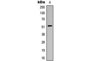 Western blot analysis of ALDH3B1 expression in HuvEc (A) whole cell lysates. (ALDH3B1 antibody  (Center))