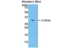 Detection of Recombinant IkBz, Mouse using Polyclonal Antibody to Inhibitory Subunit Of NF Kappa B Zeta (IkBz) (Inhibitory Subunit of NF-KappaB zeta (AA 414-654) antibody)