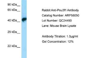 Western Blotting (WB) image for anti-POU Class 3 Homeobox 1 (POU3F1) (N-Term) antibody (ABIN2787528) (POU3F1 antibody  (N-Term))