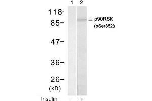 Image no. 1 for anti-Ribosomal Protein S6 Kinase, 90kDa, Polypeptide 1 (RPS6KA1) (pSer352) antibody (ABIN319222) (RPS6KA1 antibody  (pSer352))