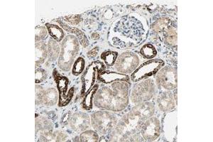 Immunohistochemical staining (Formalin-fixed paraffin-embedded sections) of human kidney with NNT polyclonal antibody  shows strong cytoplasmic positivity in cells in tubules. (NNT antibody)