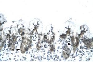 Image no. 1 for anti-Adiponectin (ADIPOQ) (AA 77-126) antibody (ABIN202115) (ADIPOQ antibody  (AA 77-126))
