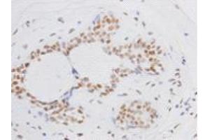 Immunohistochemistry (Paraffin-embedded Sections) (IHC (p)) image for anti-BMI1 Polycomb Ring Finger Oncogene (BMI1) antibody (ABIN1112825)