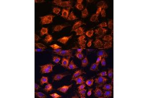 Immunofluorescence analysis of C6 cells using PTCD1 antibody (ABIN7269203) at dilution of 1:100. (PTCD1 antibody  (AA 435-537))
