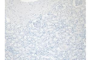 (ABIN185594) Negative Control showing staining of paraffin embedded Human Kidney, with no primary antibody (PRODH antibody  (Internal Region))