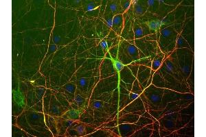 shows rat mixed neuron/glial cultures stained with mouse monoclonal antibody to neurofilament subunit NF-L MCA-7D1 (green) and ABIN1842223, chicken antibody to neurofilament NF-H. (NEFH antibody)