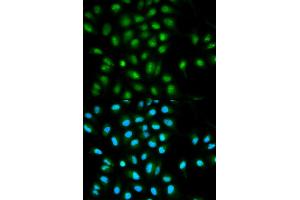 Immunofluorescence analysis of HeLa cells using PYCARD antibody (ABIN5970516). (PYCARD antibody)