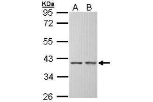 WB Image Sample (30 ug of whole cell lysate) A: Hep G2 , B: Molt-4 , 10% SDS PAGE antibody diluted at 1:5000 (SGTA antibody  (Center))