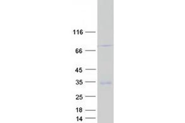 GPM6A Protein (Transcript Variant 1) (Myc-DYKDDDDK Tag)