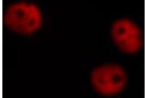 Immunofluorescence (fixed cells) (IF/ICC) image for anti-GATA Binding Protein 4 (GATA4) (pSer262) antibody (ABIN6256227)