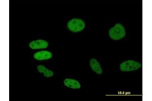 Immunofluorescence of purified MaxPab antibody to BRD2 on HeLa cell. (BRD2 antibody  (AA 1-801))