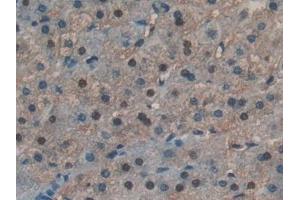 Detection of RNASE4 in Human Liver Tissue using Polyclonal Antibody to Ribonuclease A4 (RNASE4)
