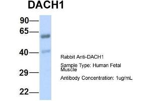 Host:  Rabbit  Target Name:  DACH1  Sample Type:  Human Fetal Muscle  Antibody Dilution:  1. (DACH1 antibody  (N-Term))