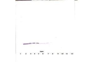 Image no. 2 for anti-Colony Stimulating Factor 2 (Granulocyte-Macrophage) (CSF2) antibody (ABIN465747) (GM-CSF antibody)