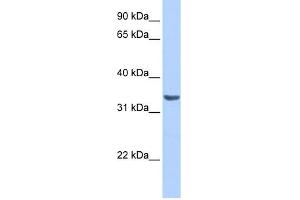RAB40A antibody used at 1 ug/ml to detect target protein. (RAB40A antibody  (Middle Region))