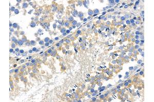 anti-WNK Lysine Deficient Protein Kinase 4 (WNK4) (pSer575) antibody
