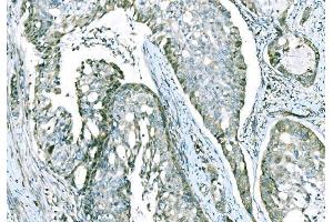 IHC analysis of CD101 using anti-CD101 antibody (ABIN7601981).