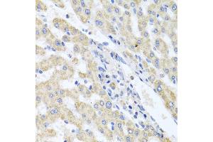 Immunohistochemistry of paraffin-embedded human liver injury using ITPKB antibody (ABIN5972108) at dilution of 1/100 (40x lens). (ITPKB antibody)