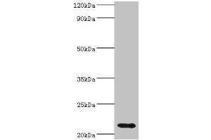 Western blot All lanes: Heat shock protein beta-8 antibody at 4 μg/mL + Rat heart tissue Secondary Goat polyclonal to rabbit IgG at 1/10000 dilution Predicted band size: 22 kDa Observed band size: 22 kDa (HSPB8 antibody  (AA 1-196))