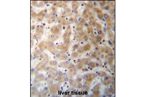 DHFRL1 Antibody (Center) (ABIN657287 and ABIN2846374) immunohistochemistry analysis in formalin fixed and paraffin embedded human liver tissue followed by peroxidase conjugation of the secondary antibody and DAB staining. (DHFRL1 antibody  (AA 45-74))