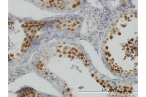 Immunoperoxidase of monoclonal antibody to NEK2 on formalin-fixed paraffin-embedded human testis. (NEK2 antibody  (AA 331-445))