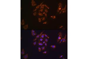 Immunofluorescence analysis of H9C2 cells using TRH Rabbit pAb (ABIN7270826) at dilution of 1:100. (TRH antibody  (AA 100-200))