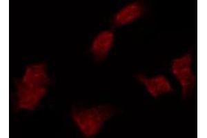 ABIN6267257 staining COS7 by IF/ICC. (ABL1 antibody  (pTyr412))