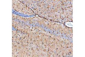 IHC analysis of Aquaporin 4 using anti-Aquaporin 4 antibody (ABIN3043789). (Aquaporin 4 antibody  (C-Term))