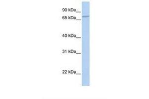 Image no. 1 for anti-Coenzyme Q8A (COQ8A) (AA 146-195) antibody (ABIN6738454) (COQ8A antibody  (AA 146-195))