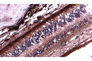 Immunohistochemistry (IHC) image for anti-Arrestin 3, Retinal (X-Arrestin) (ARR3) (C-Term) antibody (ABIN570667)