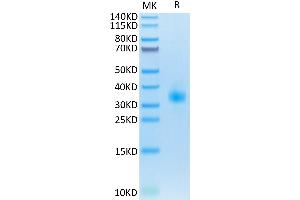 Mouse SOST on Tris-Bis PAGE under reduced condition. (Sclerostin Protein (SOST) (AA 24-211) (His tag))