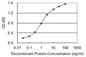Detection limit for recombinant GST tagged LMTK3 is 0. (LMTK3 antibody  (AA 1151-1250))
