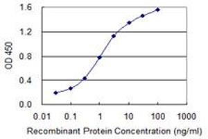 Detection limit for recombinant GST tagged LMTK3 is 0. (LMTK3 antibody  (AA 1151-1250))