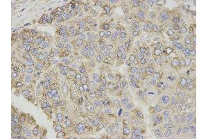 Immunohistochemistry (IHC) image for anti-Carnitine Palmitoyltransferase 1A (Liver) (CPT1A) antibody (ABIN1876495) (CPT1A antibody)