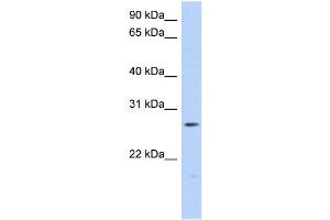 WB Suggested Anti-MTHFS Antibody Titration: 0. (MTHFS antibody  (Middle Region))