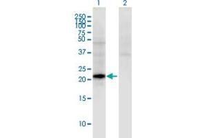 Western Blot analysis of CGB5 expression in transfected 293T cell line by CGB5 monoclonal antibody (M02), clone 2E7.