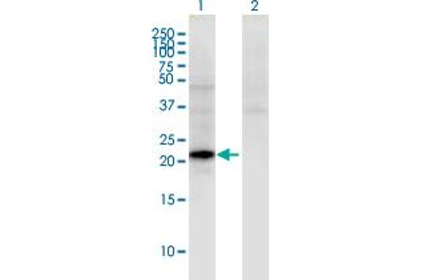 CGB5 anticorps  (AA 1-165)
