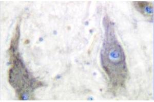 Image no. 2 for anti-Solute Carrier Family 2 (Facilitated Glucose Transporter), Member 1 (SLC2A1) antibody (ABIN265442)