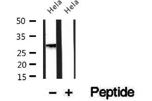 Western blot analysis of extracts of HepG2 cells, using PMM2 antibody. (PMM2 antibody  (C-Term))
