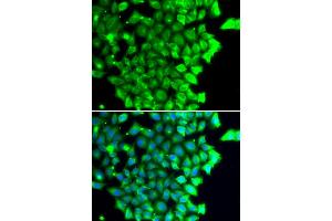 Immunofluorescence analysis of MCF-7 cells using TRIAP1 antibody (ABIN4905489). (TRIAP1 antibody)