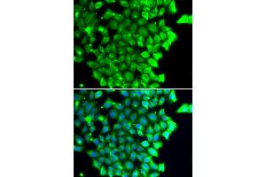 Immunofluorescence analysis of MCF-7 cells using TRIAP1 antibody (ABIN4905489).