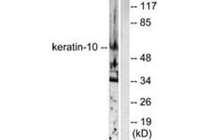 Western blot analysis of extracts from HeLa cells, using Keratin 10 Antibody. (Keratin 10 antibody  (AA 136-185))