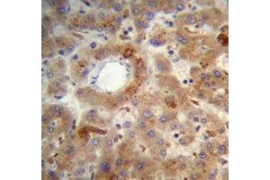 PTEN antibody immunohistochemistry analysis in formalin fixed and paraffin embedded human liver tissue. (PTEN antibody  (AA 306-335))
