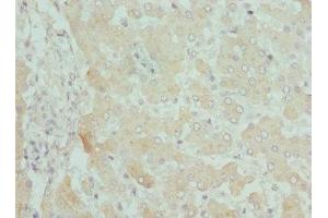 Immunohistochemistry of paraffin-embedded human liver tissue using ABIN7146778 at dilution of 1:100 (CPN1 antibody  (AA 209-458))